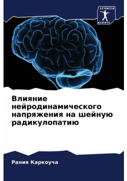 Влияние нейродинамического напряжения на шейную радикулопатию