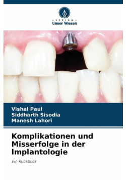 Komplikationen und Misserfolge in der Implantologie