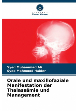 Orale und maxillofaziale Manifestation der Thalassämie und Management