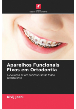 Aparelhos Funcionais Fixos em Ortodontia