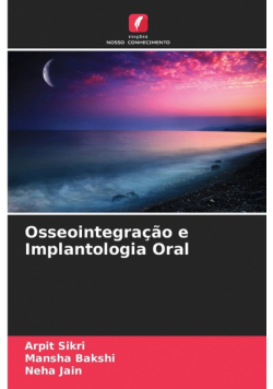 Osseointegração e Implantologia Oral