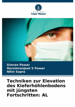 Techniken zur Elevation des Kieferhöhlenbodens mit jüngsten Fortschritten