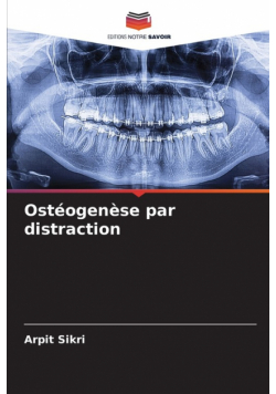 Ostéogenèse par distraction