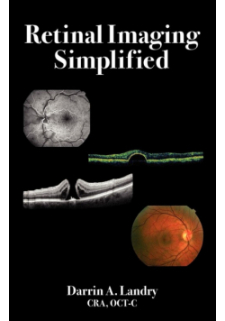 Retinal Imaging Simplified