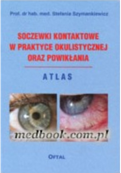 Soczewki kontaktowe w praktyce okulistycznej oraz powikłania