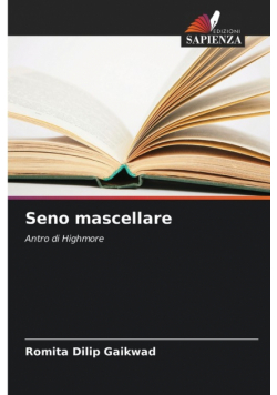 Seno mascellare