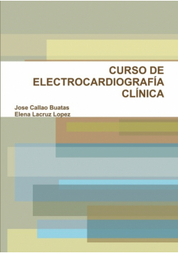 Ecg