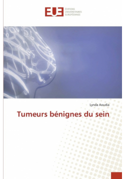 Tumeurs bénignes du sein