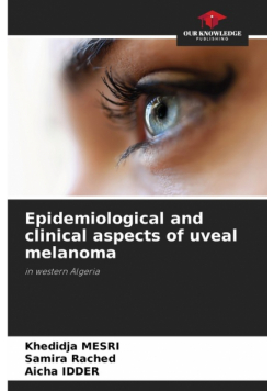 Epidemiological and clinical aspects of uveal melanoma