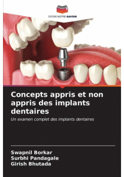 Concepts appris et non appris des implants dentaires