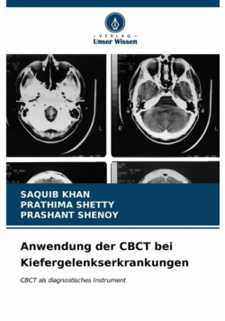 Anwendung der CBCT bei Kiefergelenkserkrankungen