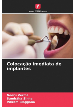 Colocação imediata de implantes