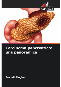 Carcinoma pancreatico