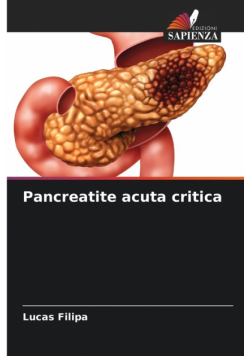 Pancreatite acuta critica