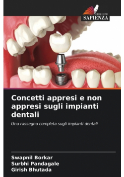 Concetti appresi e non appresi sugli impianti dentali