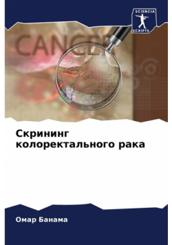 Скрининг колоректального рака