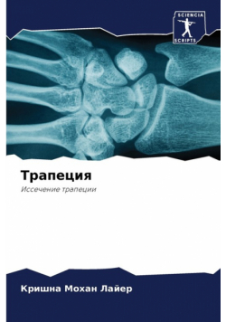 Трапеция