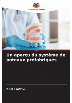 Un aperçu du système de poteaux préfabriqués