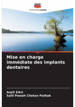 Mise en charge immédiate des implants dentaires