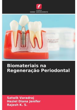 Biomateriais na Regeneração Periodontal