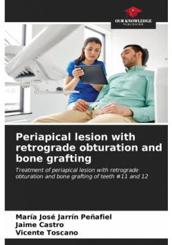 Periapical lesion with retrograde obturation and bone grafting