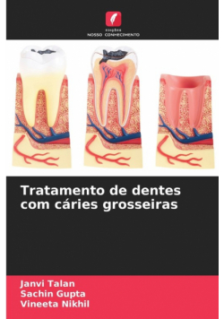 Tratamento de dentes com cáries grosseiras