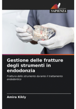 Gestione delle fratture degli strumenti in endodonzia