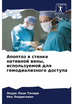 Апоптоз в стенке нативной вены, используемой для гемодиализного доступа