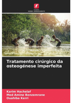 Tratamento cirúrgico da osteogénese imperfeita