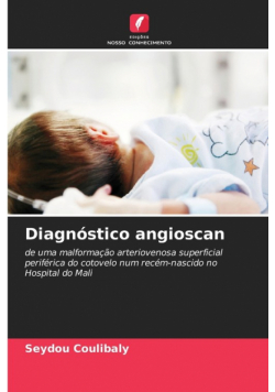 Diagnóstico angioscan