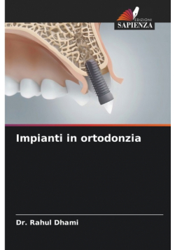 Impianti in ortodonzia