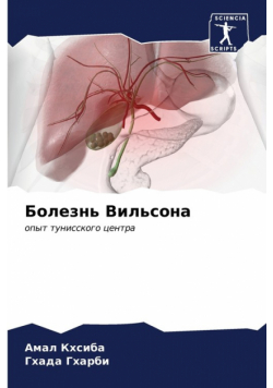 Болезнь Вильсона