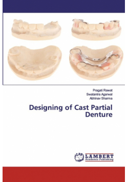 Designing of Cast Partial Denture