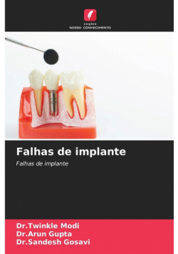 Falhas de implante