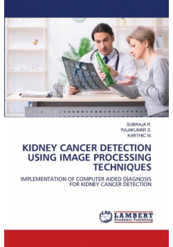 Kidney Cancer Detection Using Image Processing Techniques
