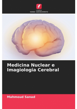 Medicina Nuclear e Imagiologia Cerebral