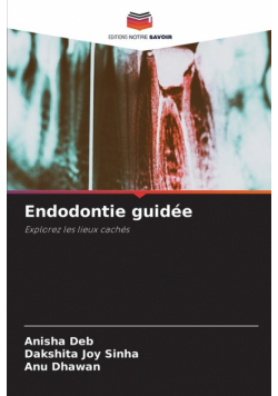 Endodontie guidée