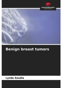 Benign breast tumors