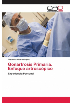 Gonartrosis Primaria. Enfoque artroscópico