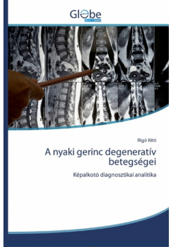 A nyaki gerinc degeneratív betegségei