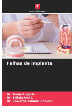 Falhas de implante