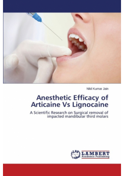 Anesthetic Efficacy of Articaine Vs Lignocaine