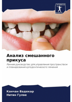 Анализ смешанного прикуса