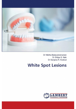 White Spot Lesions