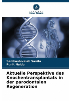 Aktuelle Perspektive des Knochentransplantats in der parodontalen Regeneration
