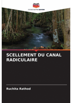 Scellement Du Canal Radiculaire