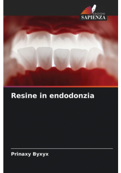 Resine in endodonzia