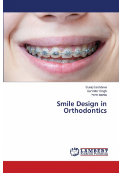 Smile Design in Orthodontics