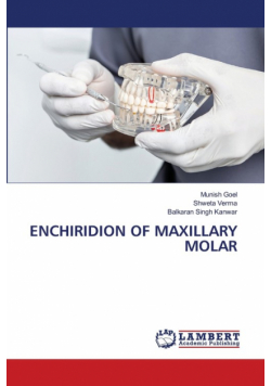 Enchiridion Of Maxillary Molar
