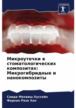 Микроутечки в стоматологических композитах